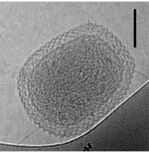 An ultra-small bacterial cell (scale bar is 100 nanometers) is thought to be a relative of the microorganisms that encode diversity-generating retroelements. Photo Credit: BIRGIT LUEF, NORWEGIAN UNIVERSITY OF SCIENCE AND TECHNOLOGY